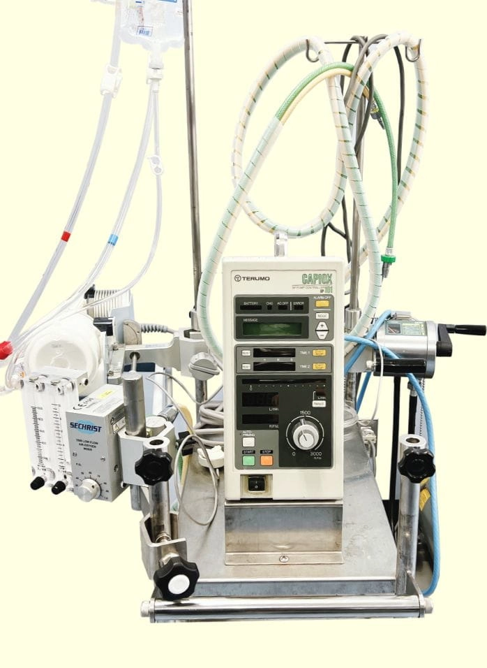 体外式膜型人工肺（ECMO）の画像